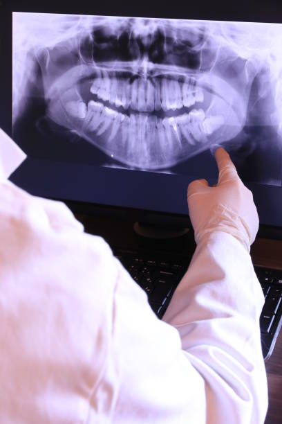 Best Emergency Treatment for Oral Infections in Blackhawk, SD